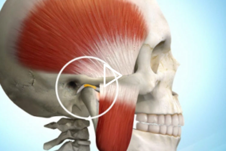 Video Craniomandibuläre Dysfunktion (CMD) – Professor Lindorf, PD von Wilmowsky und Kollegen – Mund Kiefer Gesicht Chirurgie Nürnberg